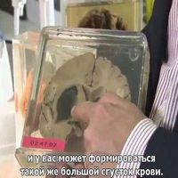 Инсульт, травмы и заболевания головного мозга