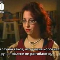 дети-инвалиды, люди с врождёнными дефектами