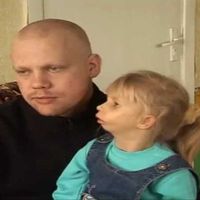 дети-инвалиды, люди с врождёнными дефектами