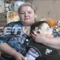 дети-инвалиды, люди с врождёнными дефектами